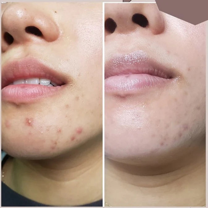 Cell Core Pro LED MASK (pre-order)