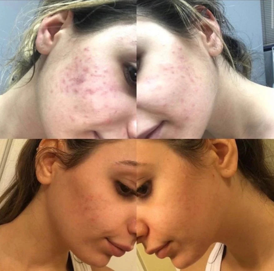 Cell Core Pro LED MASK (pre-order)