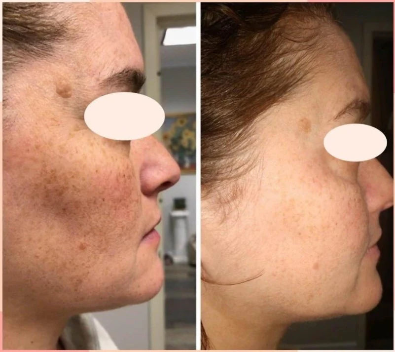 Cell Core Pro LED MASK (pre-order)